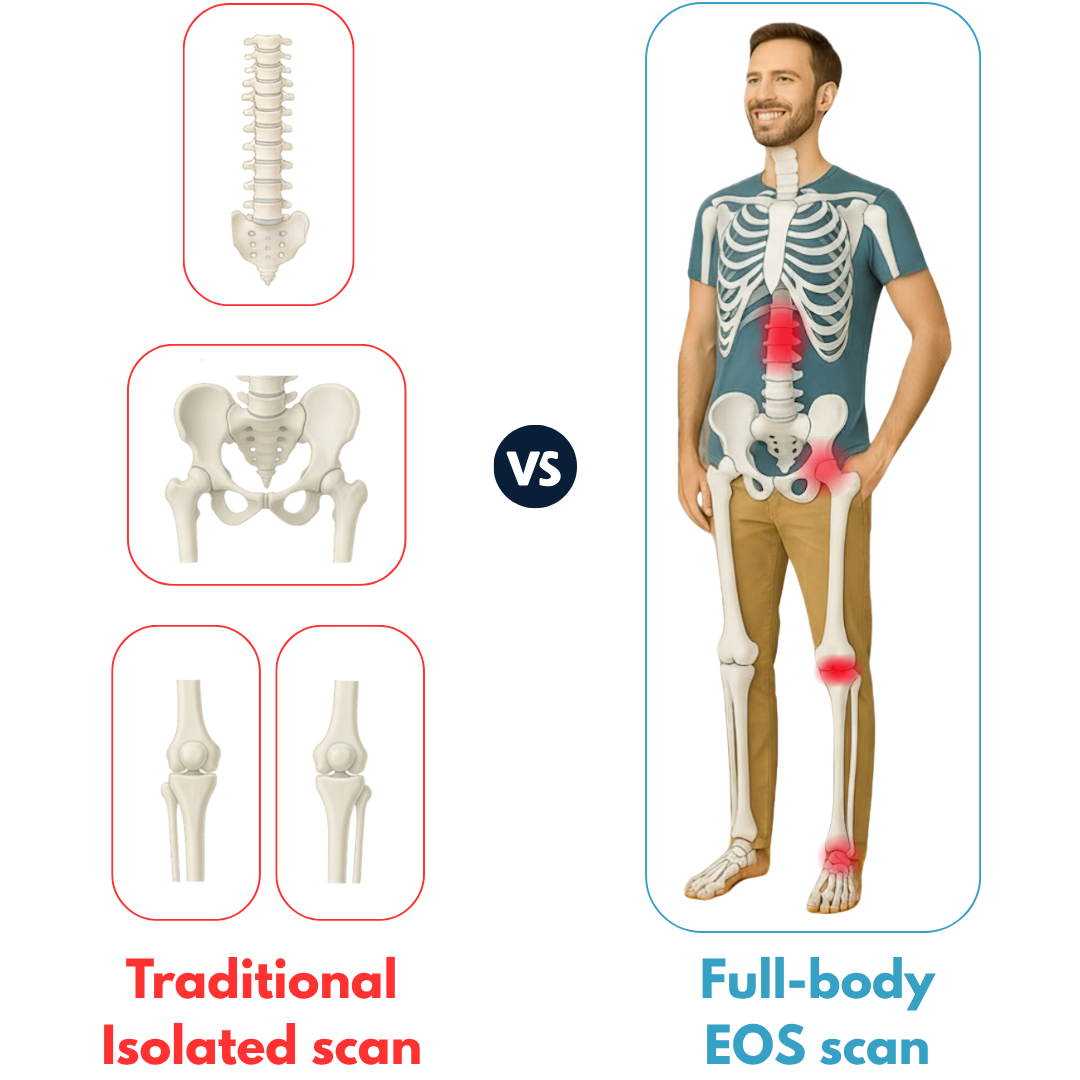 EOS hip imbalance scan